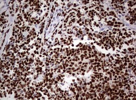 PAX5 Antibody (clone OTI5A6)