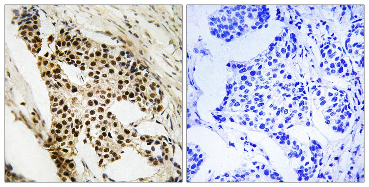 MAPKAPK2 / MAPKAP Kinase 2 Antibody (p272)