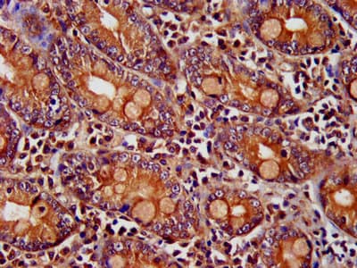 PNPLA8 Antibody