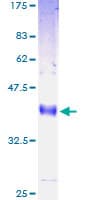 Human LY6H Protein (Recombinant GST)