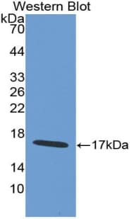 WFDC5 / PRG5 Antibody (aa1-123)