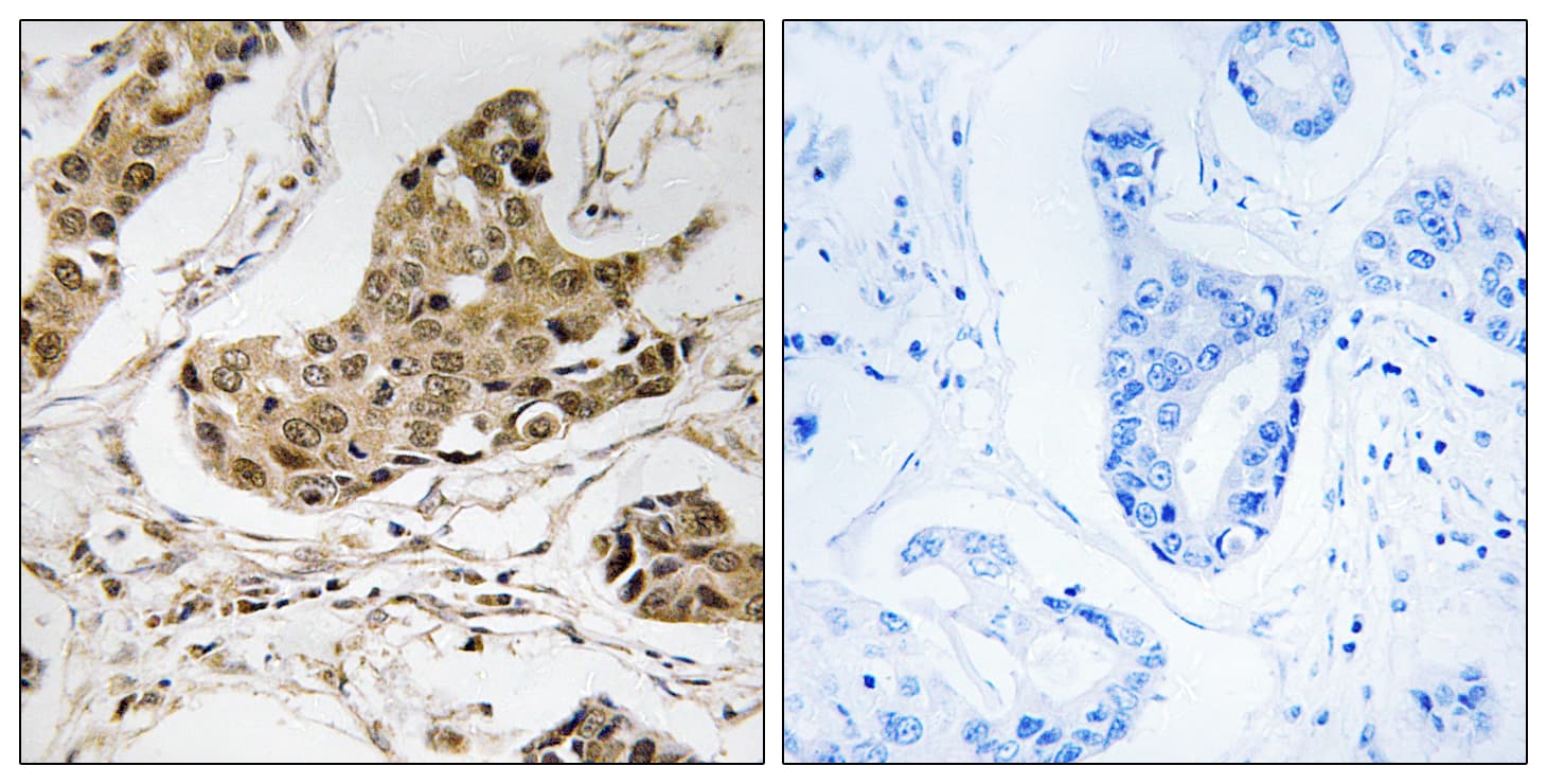 Polyclonal Rabbit anti-Human RTCD1 / RPC Antibody (aa317-366, IHC, WB)