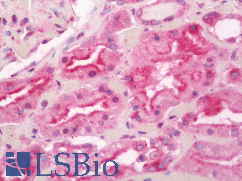 IHC-plus™ SCA2 / LY6E Antibody (aa17-66)