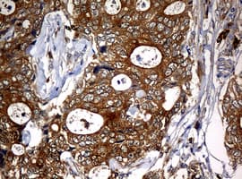 NME1 / NM23 Antibody (clone OTI1C12)