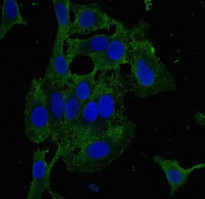 ZKSCAN3 / ZNF306 Antibody