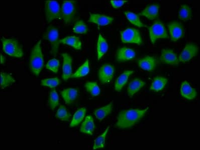 Polyclonal Rabbit anti-Human CLEC4M / L-SIGN / CD299 Antibody (WB)