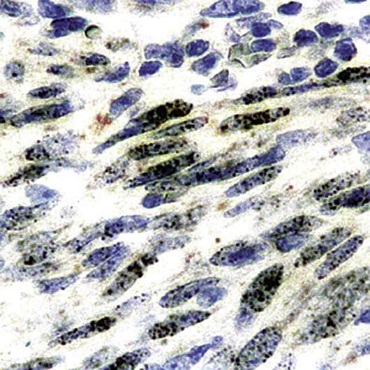 HHV-8 / HHV8 / KSHV Antibody (clone LN53)