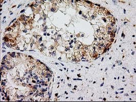 CAT / Catalase Antibody (clone OTI3C3)