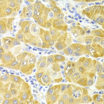 CYP2E1 Antibody