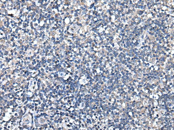 Polyclonal Rabbit anti-Human TRIM23 Antibody (IHC)