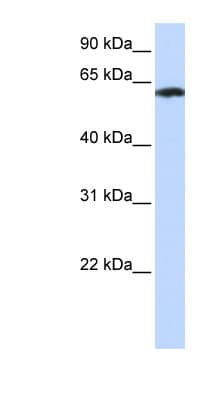 FBXO24 Antibody (aa467-516)
