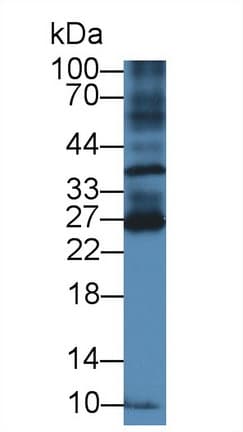 BTLA / CD272 Antibody (aa30-183, APC)