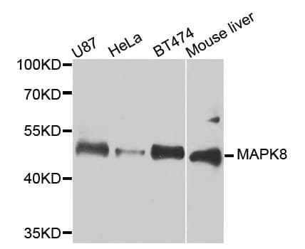 Polyclonal Rabbit anti-Human MAPK8 / JNK1 Antibody (IHC, IF, WB)