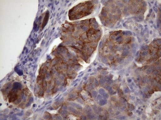 Monoclonal Mouse anti-Human XRCC6BP1 Antibody (clone OTI5F3, IHC, WB)