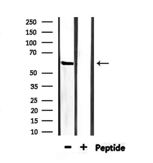 IFNAR1 / IFNAR Antibody