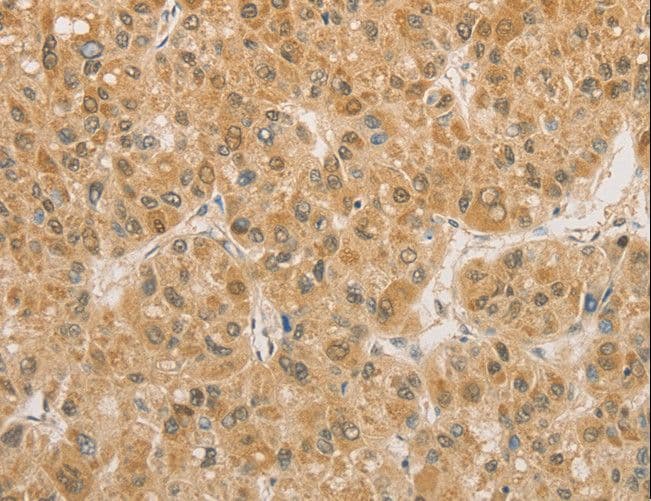 PGK2 Antibody