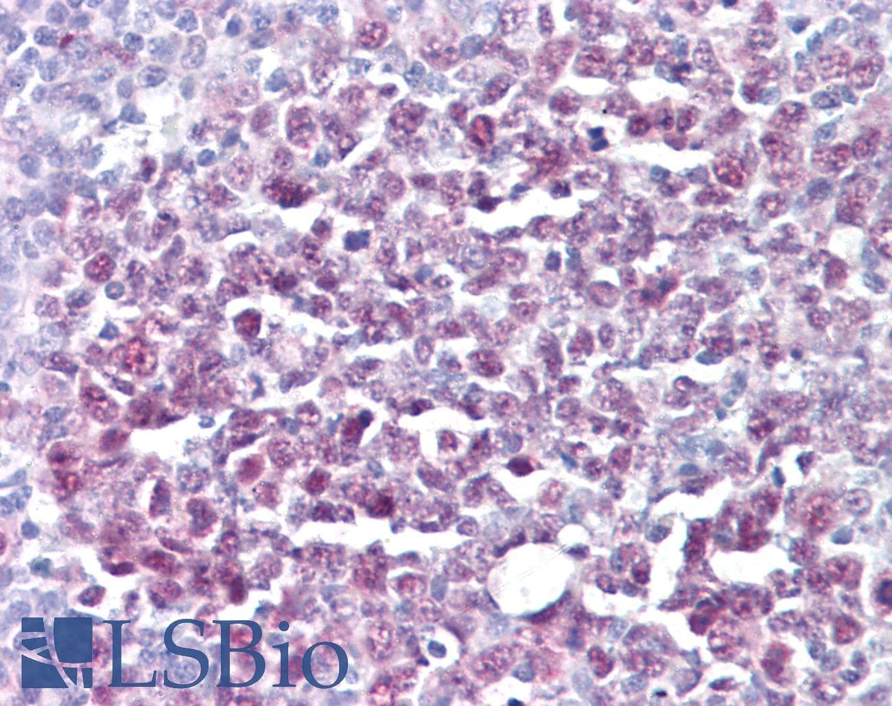 IHC-plus™ Monoclonal Mouse anti-Human MCM5 Antibody (clone CRCT5.1, IHC)