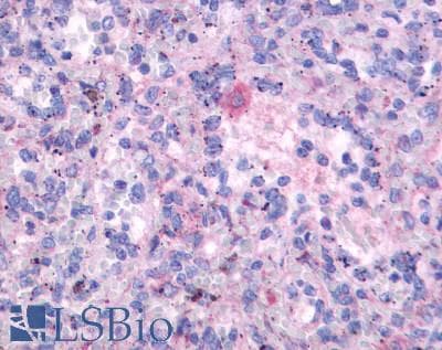 IHC-plus™ FPR3 / FPRL2 Antibody (N-Terminus)