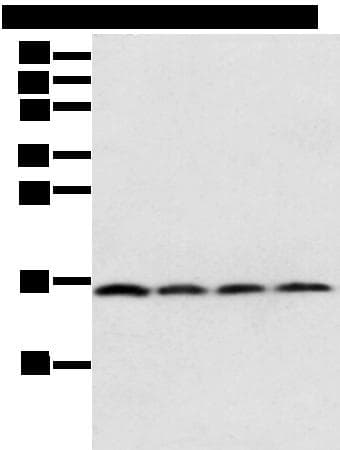 Polyclonal Rabbit anti-Human MRPS18C Antibody (IHC, WB)