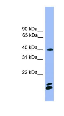 NFATC1 / NFAT2 Antibody (aa201-250)