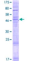 Human TLCD1 Protein (Recombinant GST)
