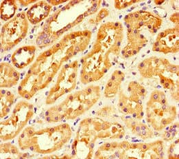 Polyclonal Rabbit anti-Human PDK4 Antibody (IHC)
