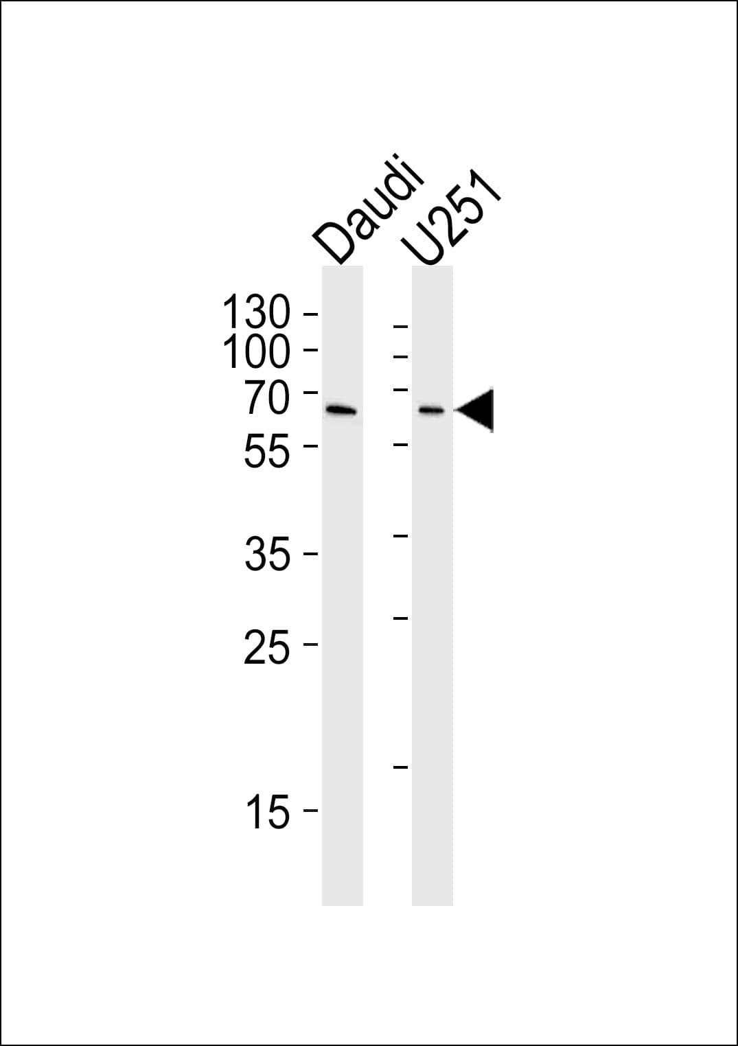 YY1 Antibody (clone 1183CT6.5.23.6)