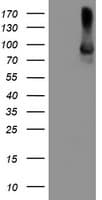 ALOX15 / 15-Lipoxygenase Antibody (clone OTI2G3)