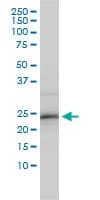 RNF114 / ZNF313 Antibody (clone 4G3-1A10)