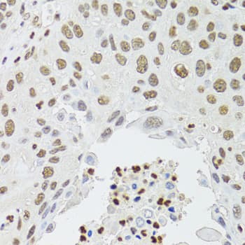 CDX2 Antibody