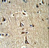 GPD1 Antibody (aa28-57)