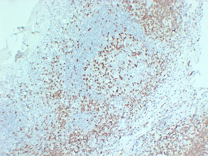 ZAP70 Antibody (clone ABT-ZAP70)