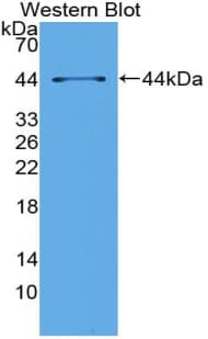 MAPT / Tau Antibody (aa92-400, Cy3)