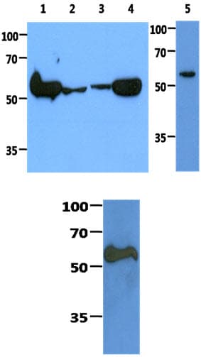 PKM2 Antibody (clone AT1B10)