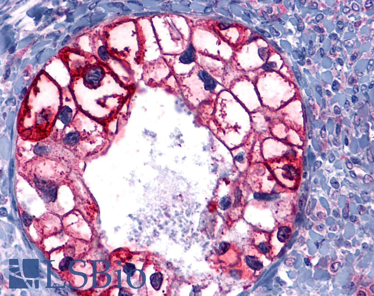 PathPlus™ GPCR6 / GPR101 Antibody (Cytoplasmic Domain)