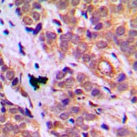 Polyclonal Rabbit anti-Human HSPB1 / HSP27 Antibody (Internal, IHC, WB)