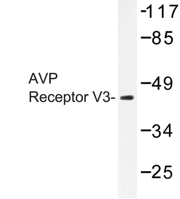 AVPR1B Antibody (Asp314)