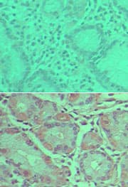 Polyclonal Rabbit anti-Human PLD2 / Phospholipase D2 Antibody (aa199-216, IHC)