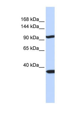 PAPPA2 / Pappalysin 2 Antibody (aa108-157)