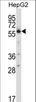 SLC30A1 / ZNT1 Antibody (aa458-487)
