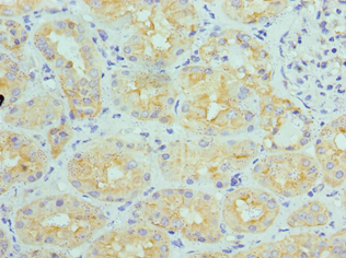 IHC-plus™ ATP6V1B1 Antibody (aa1-280)