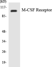 CSF1R / CD115 / FMS Antibody (aa669-718)