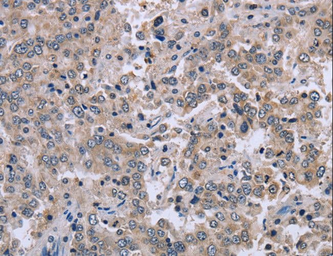 EID1 / EID-1 Antibody
