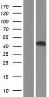 SHBG Protein (Over-Expression Lysate Myc-DDK (Flag))