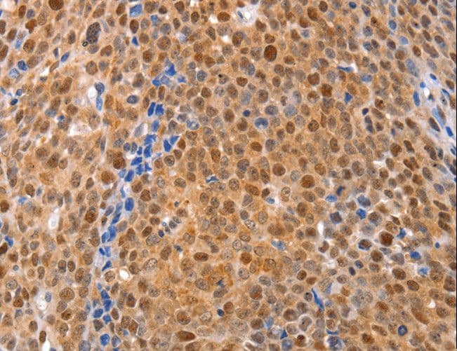 DUSP4 / MKP2 Antibody