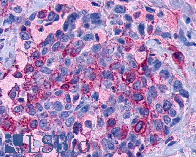 PathPlus™ Polyclonal Rabbit anti-Human LPAR3 / LPA3 / EDG7 Antibody (Cytoplasmic Domain, IHC)