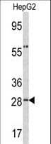 ORM1 / Orosomucoid Antibody (aa152-180)