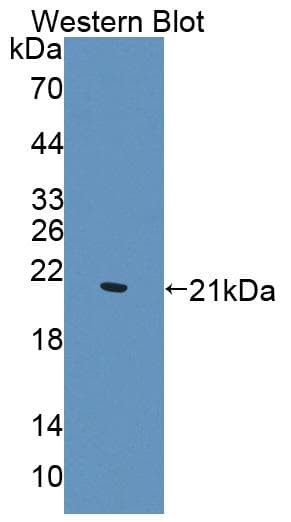 WTAP Antibody (aa1-150)