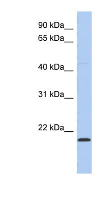 RWDD4A / RWDD4 Antibody (C-Terminus)