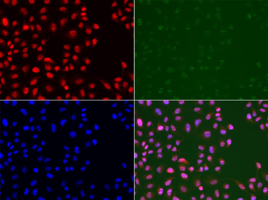 Polyclonal Rabbit anti-Human MSH2 Antibody (IHC, IF, WB)